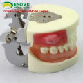 Oral Surgery Area Trainingsmodell Inzisionspus Removal Practice Model 12605